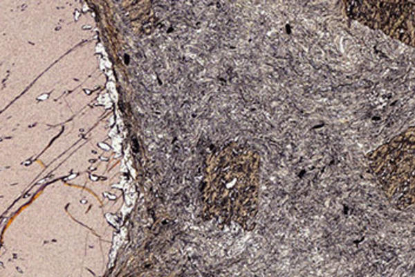 Karakoram schist